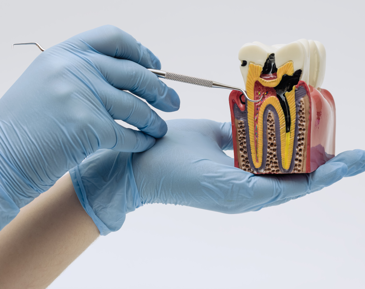 https://www.filotimedical.com/wp-content/uploads/2026/05/Endodontie-si-parodontologie.png