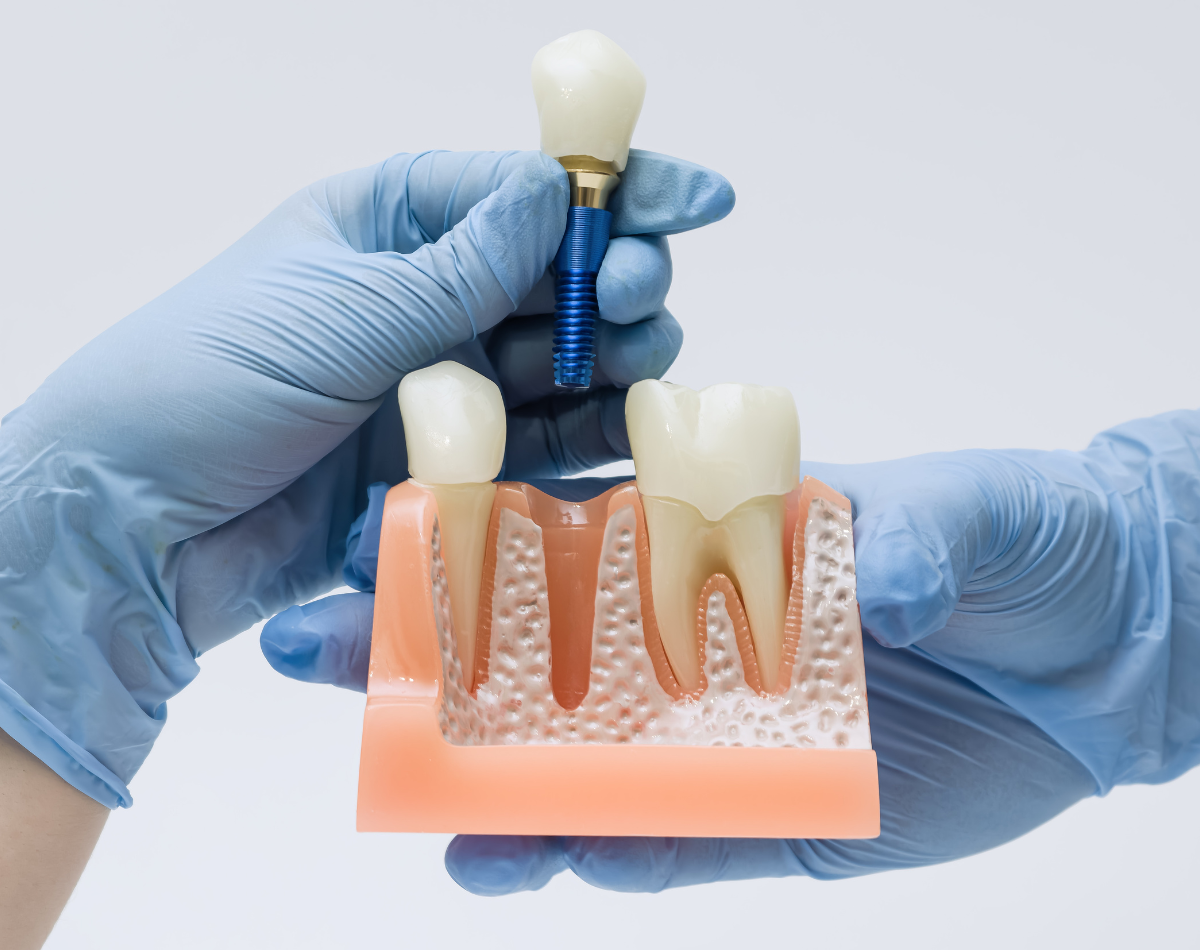 https://www.filotimedical.com/wp-content/uploads/2026/05/Implantologie-si-reabilitari.png