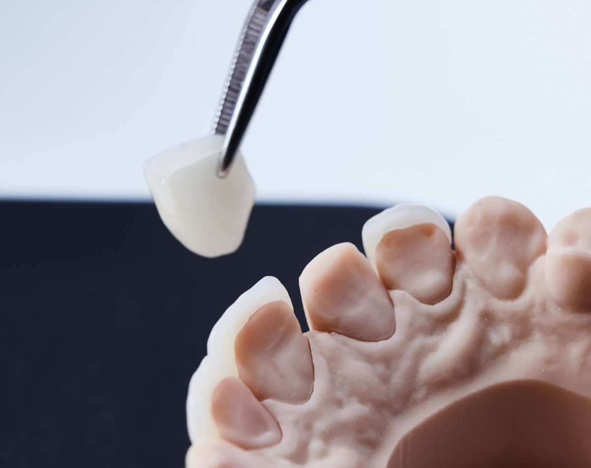 https://www.filotimedical.com/wp-content/uploads/2026/05/Protetica-si-estetica-dentara.png